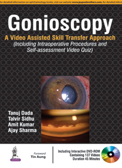 gonioscopya-video-assisted-skill-transfer-approach-with-dvd-rom