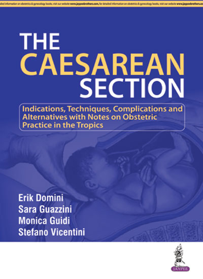 the-caesarean-seciton