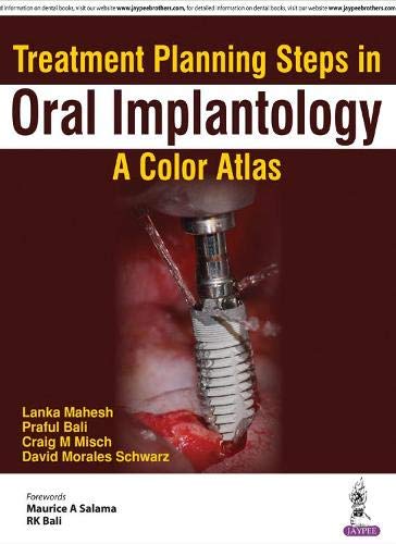 treatment-planning-steps-in-oral-implantologya-color-atlas