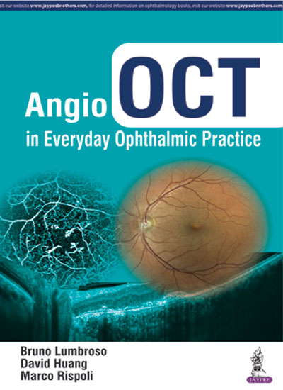angio-oct-in-everyday-ophthalmic-practice