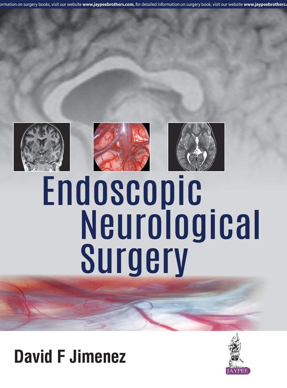 endoscopic-neurological-surgery