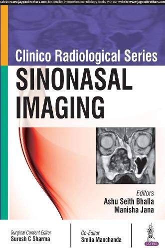 clinico-radioloical-seriessinonasal-imaging