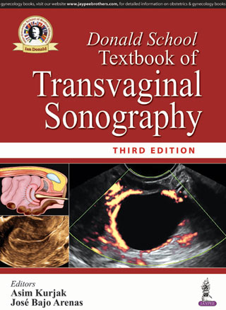 donald-school-textbook-of-transvaginal-sonography