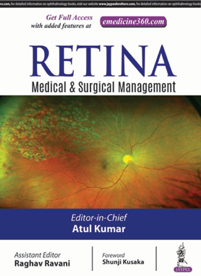 retina-medical-and-surgical-management