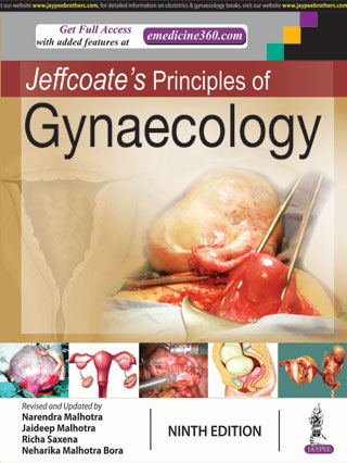 jeffcoates-principles-of-gynaecology