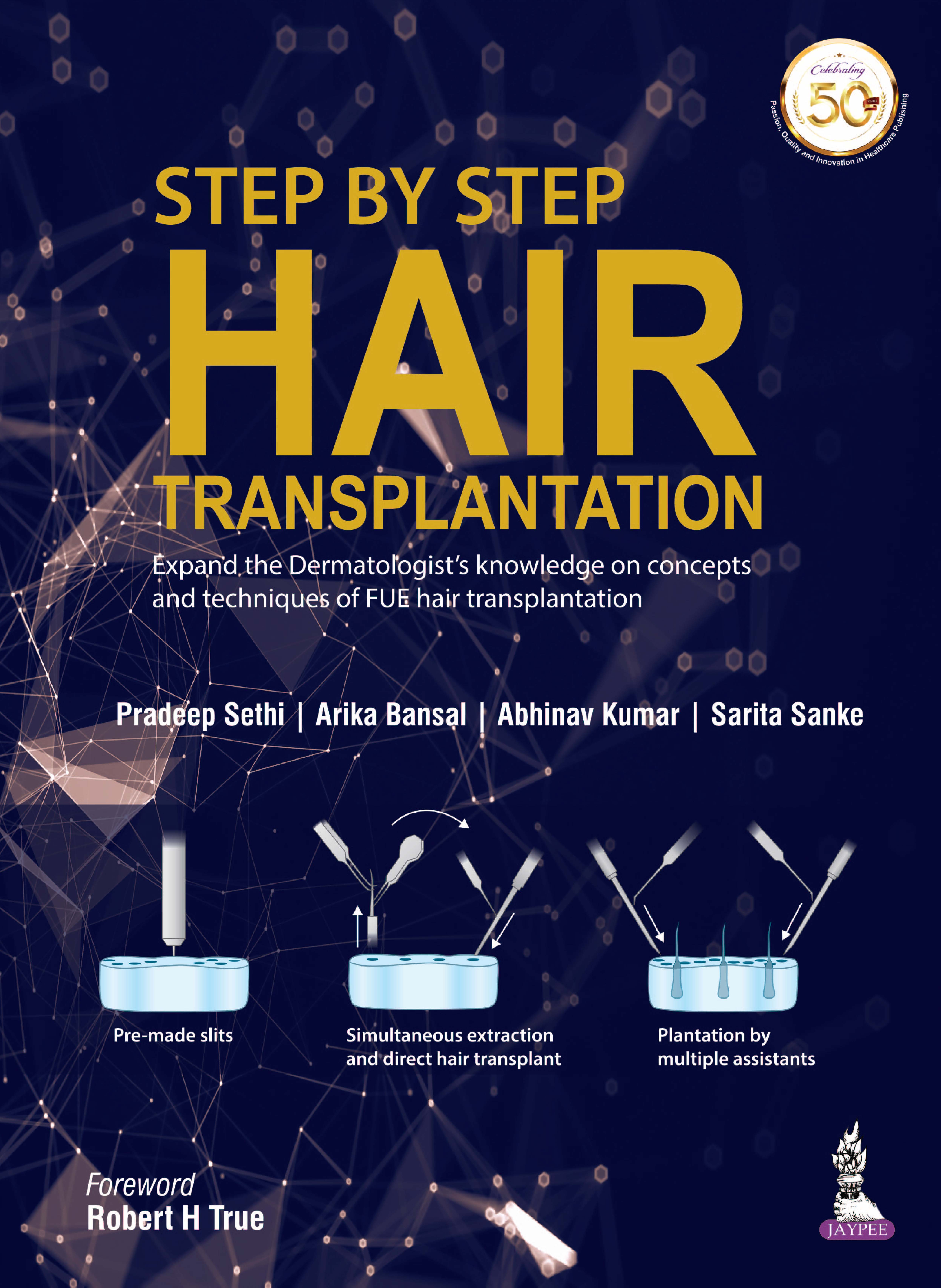 step-by-step-hair-transplantation
