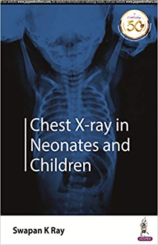 chest-x-ray-in-neonates-and-children