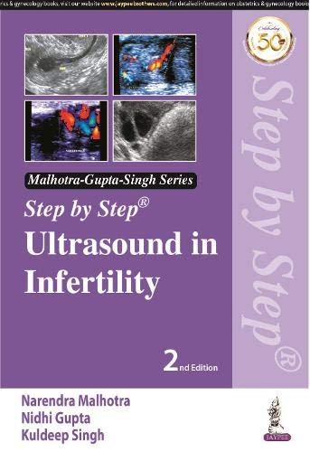 step-by-step-ultrasound-in-infertility
