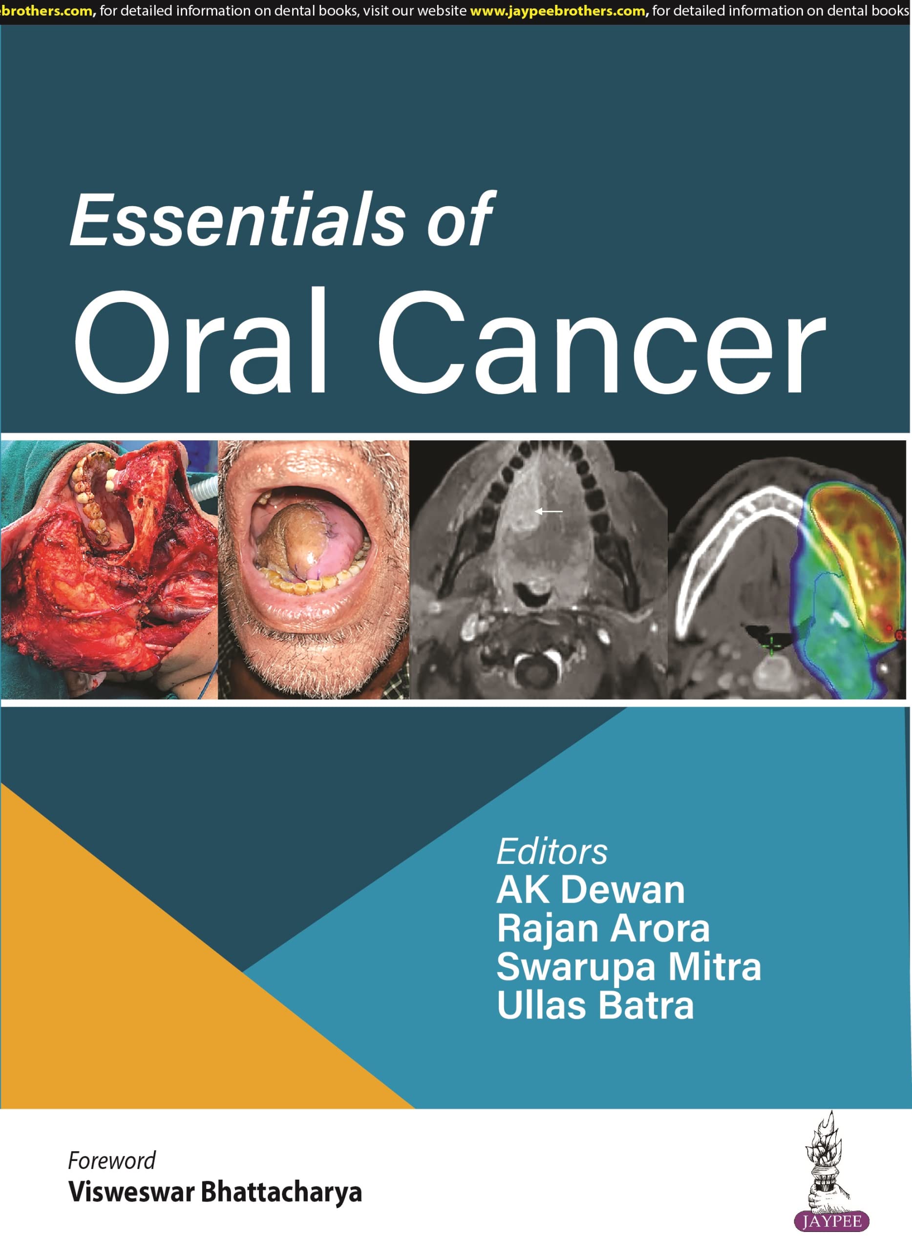 essentials-of-oral-cancer