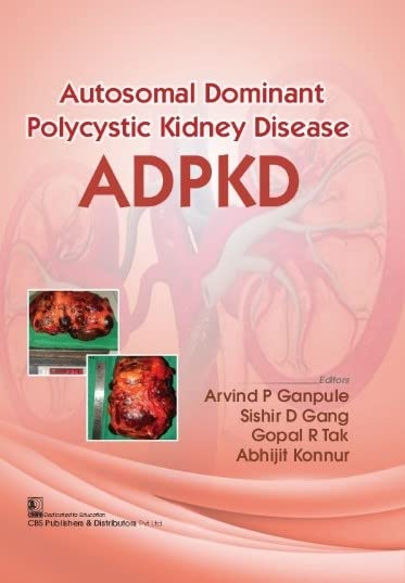autosomal-dominant-polycystic-kidney-disease-adpkd-