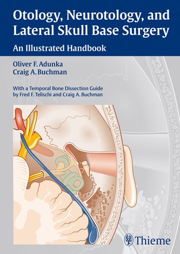 otology-neurotology-and-lateral-skull-base-surgery-an-illustrated-handbook-1e