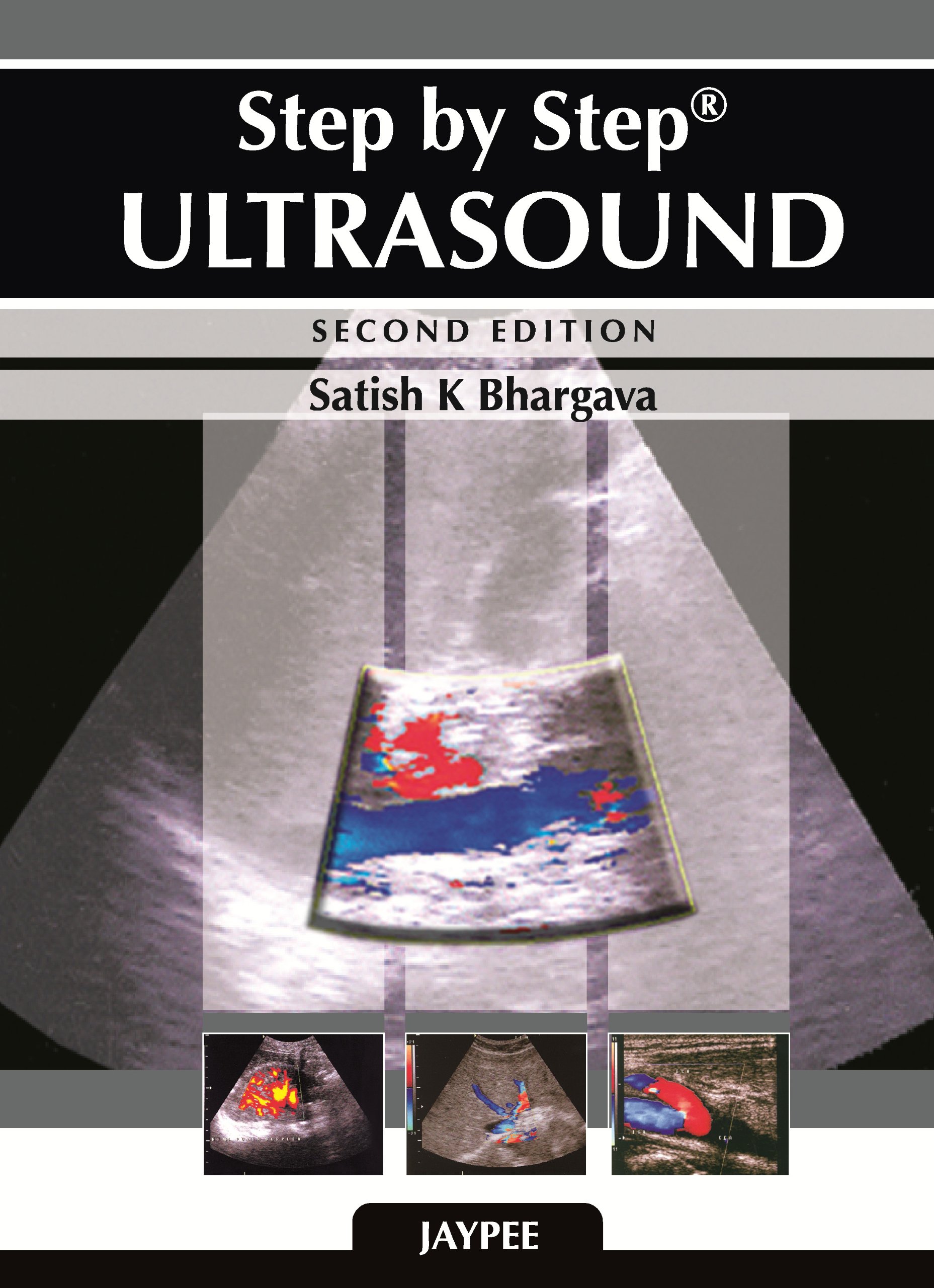step-by-step-ultrasound