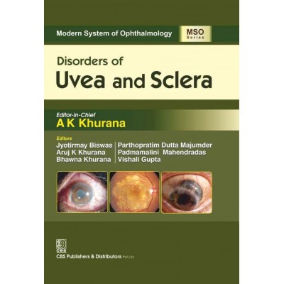 modern-system-of-ophthalmology-mso-series-disorders-of-uvea-and-sclera