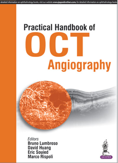 practical-handbook-of-oct-angiography