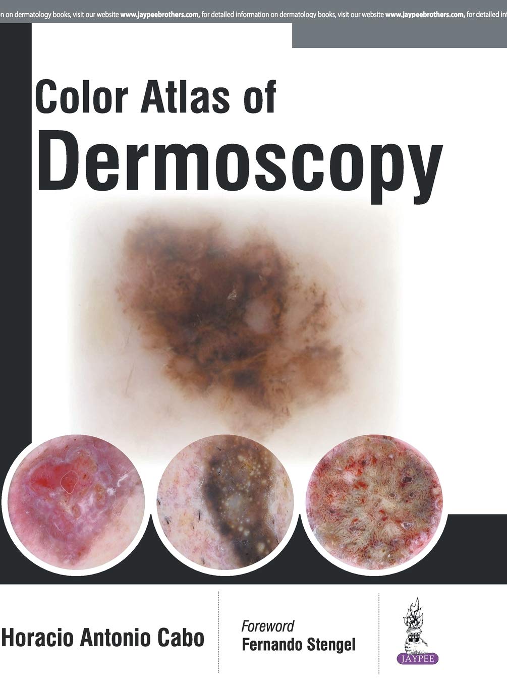 color-atlas-of-dermoscopy