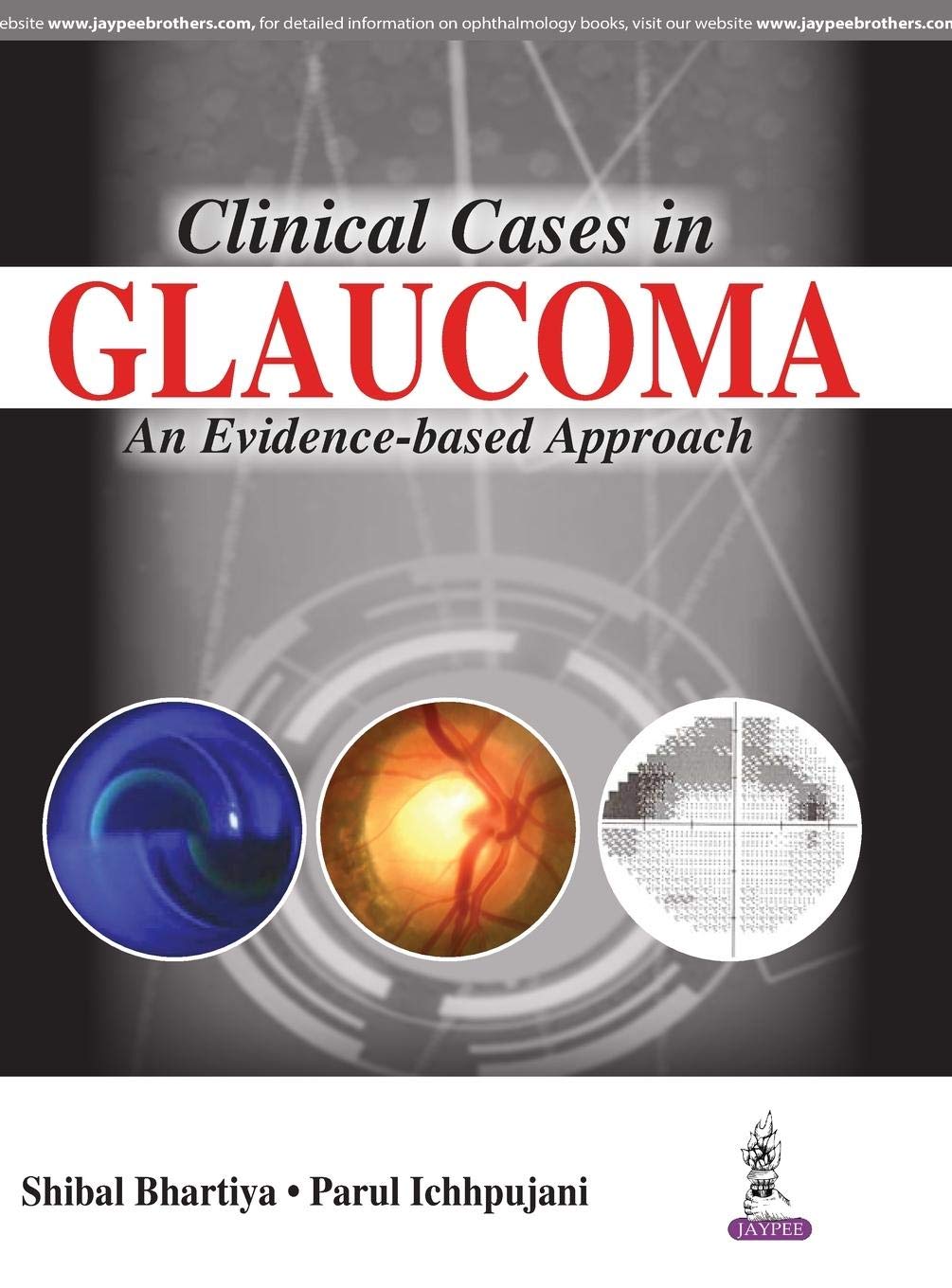 clinical-cases-in-glaucoma-an-evidence-based-approach