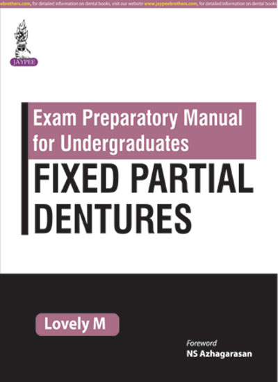 exam-preparatory-manaul-for-undergraduates-fixed-partial-dentures