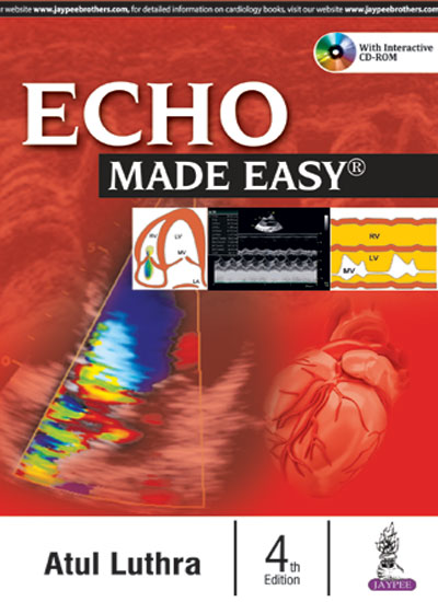 echo-made-easy-with-cd-rom
