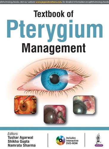 textbook-of-pterygium-management-with-dvd-rom