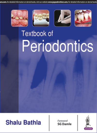 textbook-of-periodontics