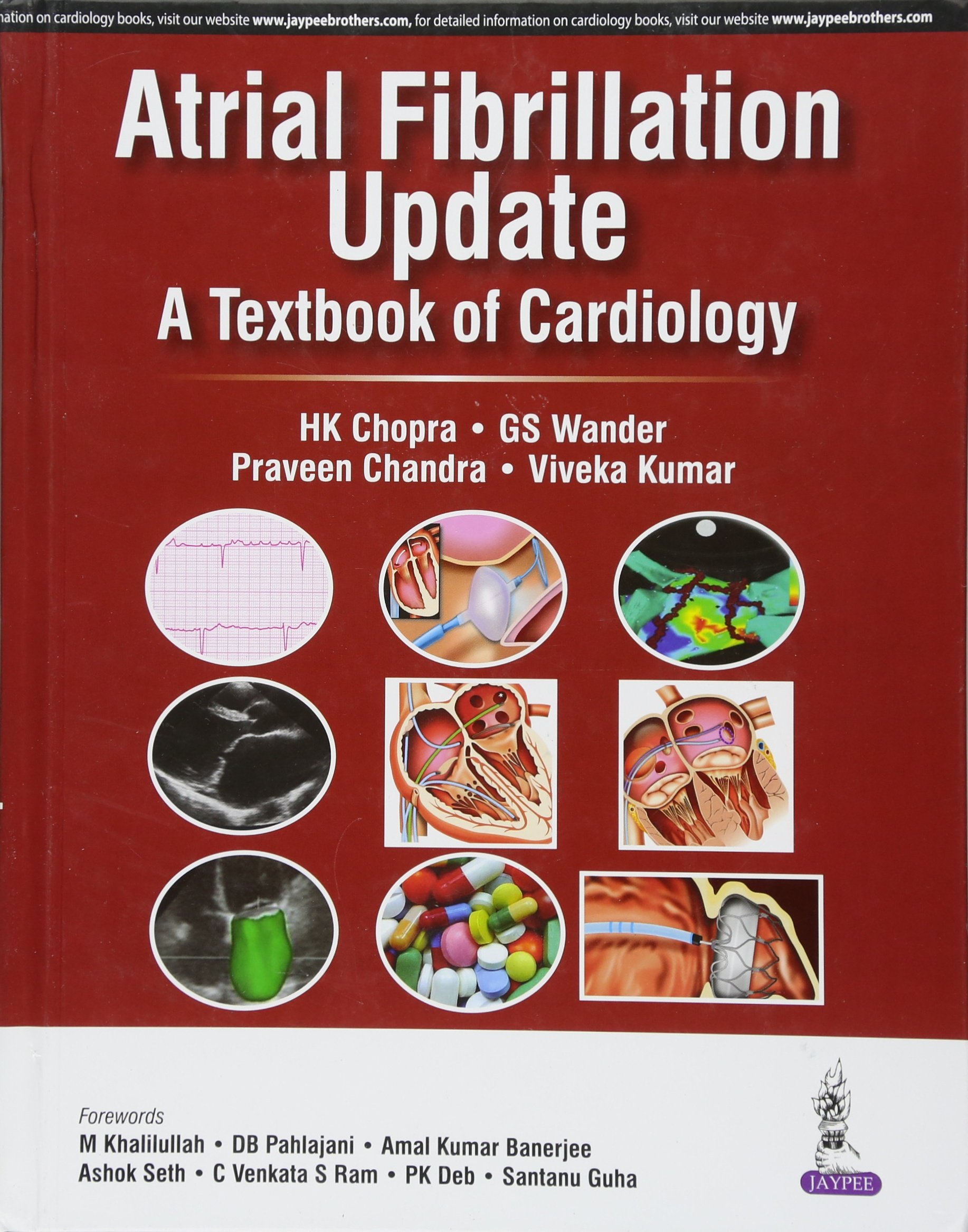 atrial-fibrillation-update-a-textbook-of-cardiology