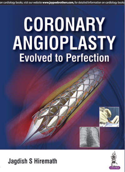 coronary-angioplasty-evolved-to-perfection