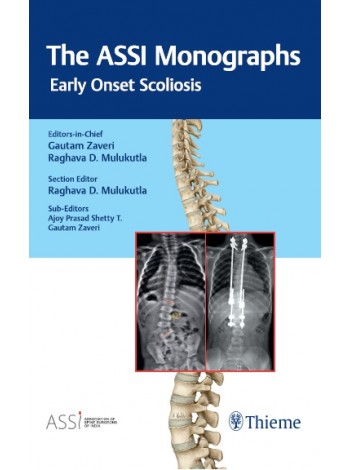 the-assi-monographs-early-onset-scoliosis-1e