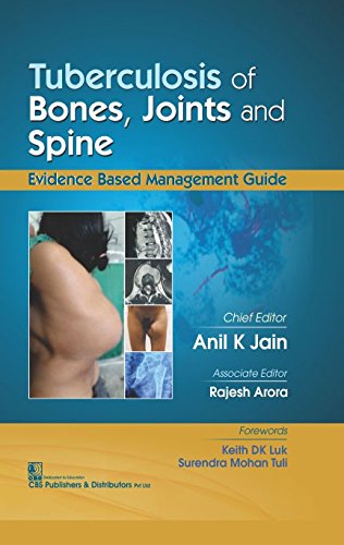 tuberculosis-of-bones-jounts-and-spice-hb