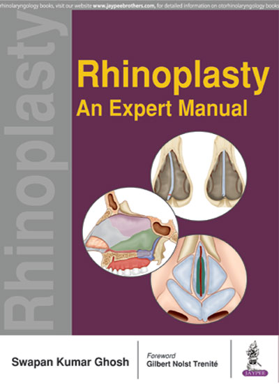 rhinoplasty-an-expert-manual