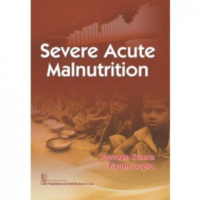 severe-acute-malnutrition-pb