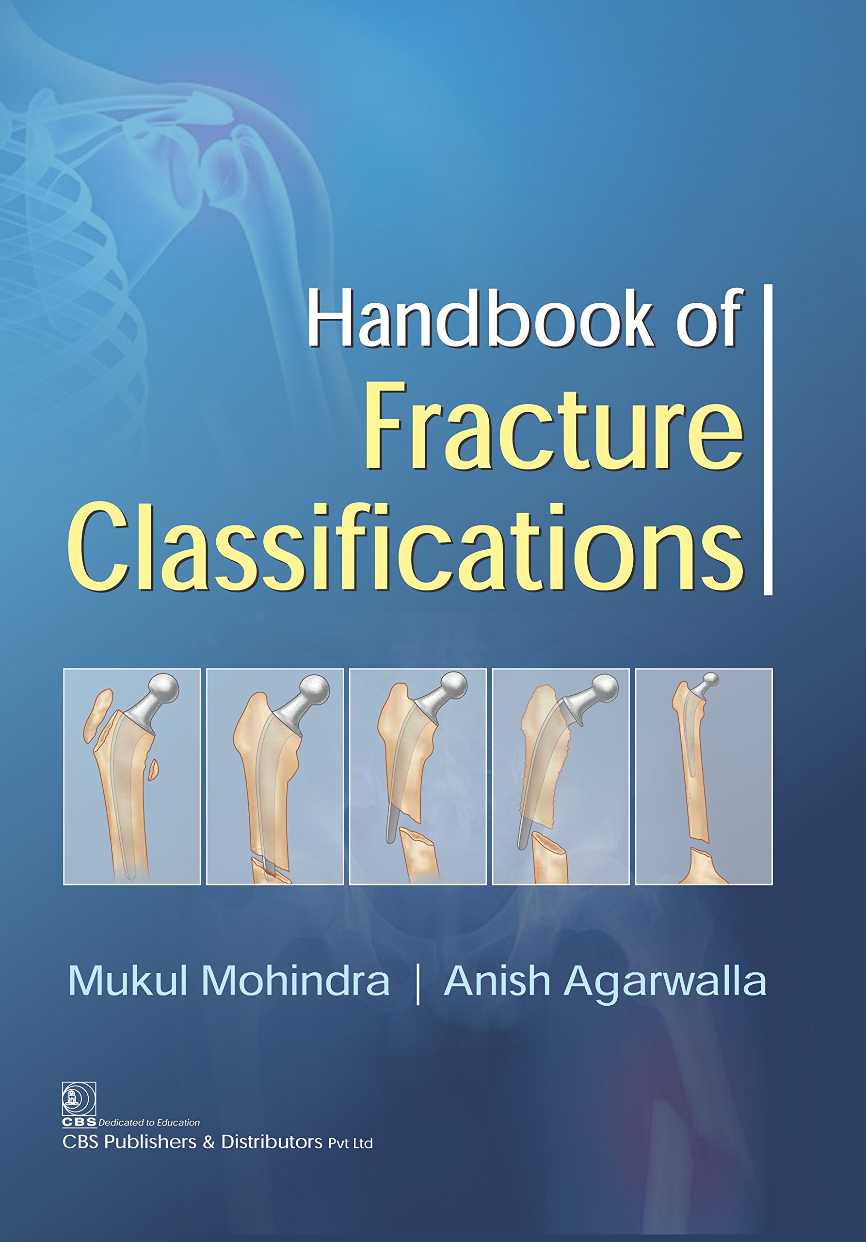 handbook-of-fracture-classifications-pb