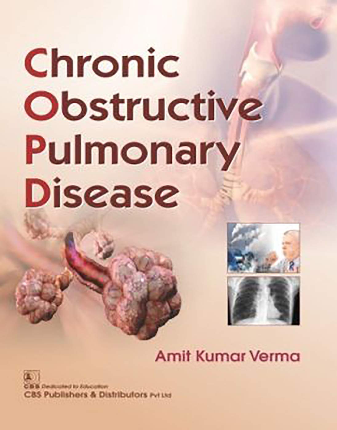 chronic-obstructive-pulmonary-disease-pb-2019