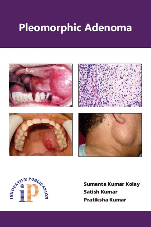 pleomorphic-adenoma