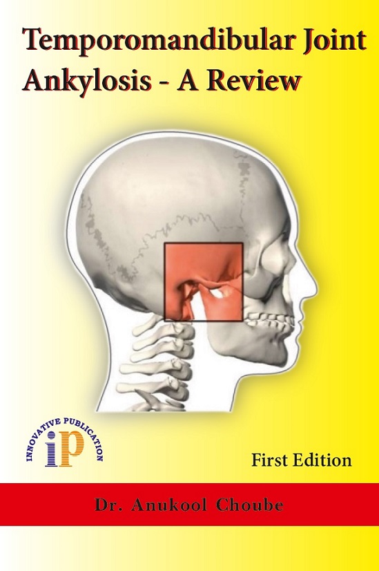 temporomandibular-joint-ankylosis-a-review