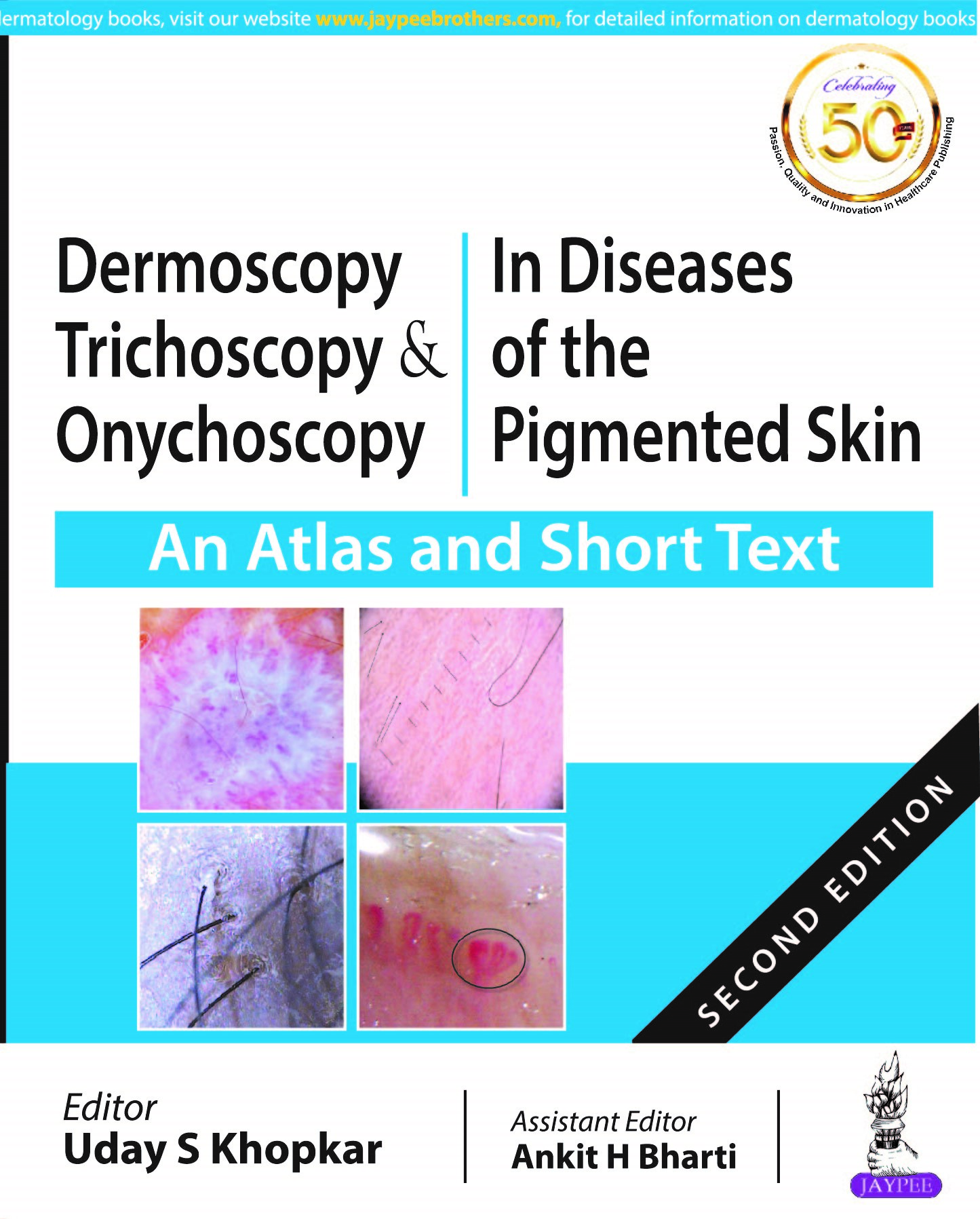 dermoscopy-trichoscopy-onychoscopy-in-diseases-of-the-pigmented-skin-an-atlas-and-short-text