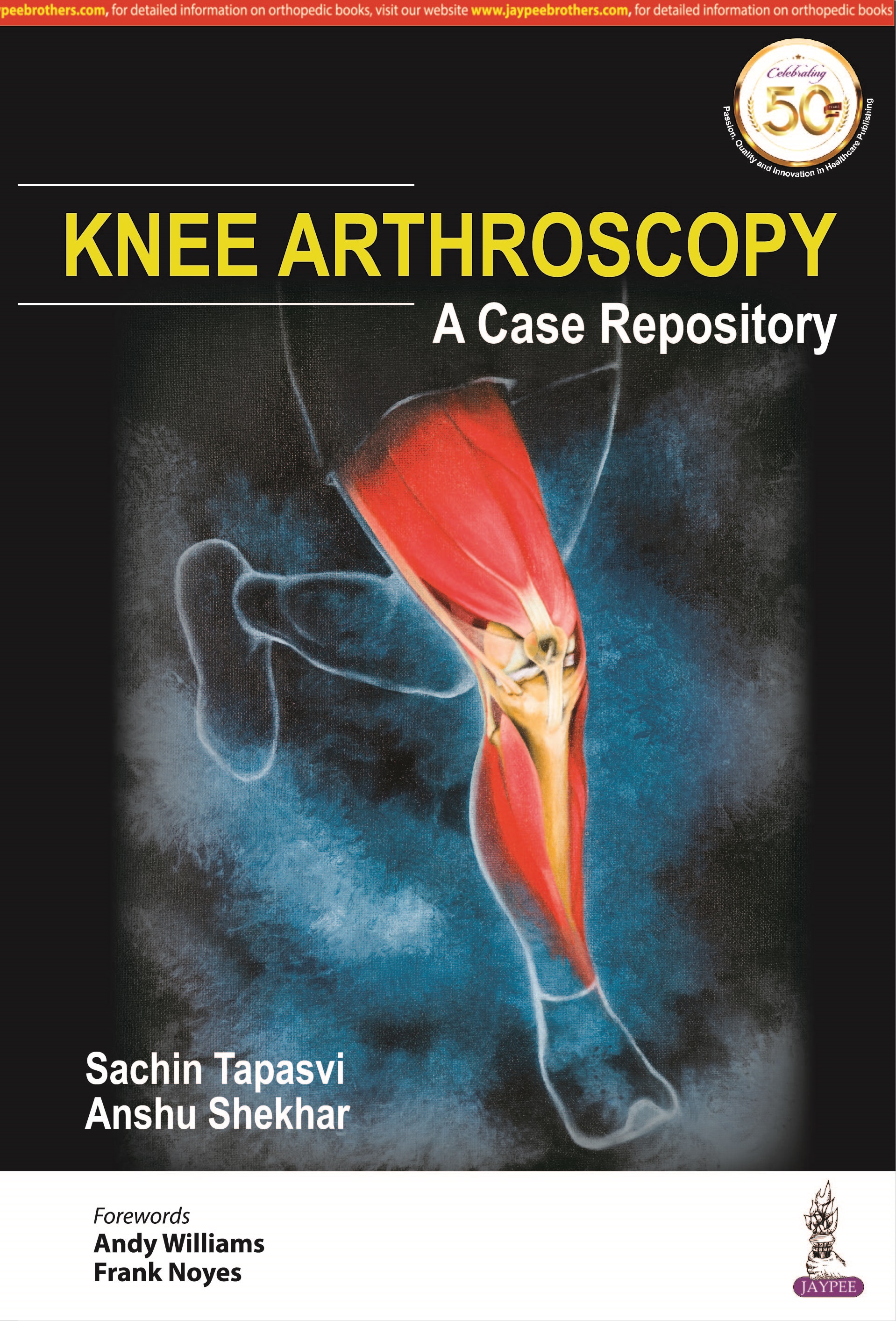 knee-arthroscopy-a-case-repository