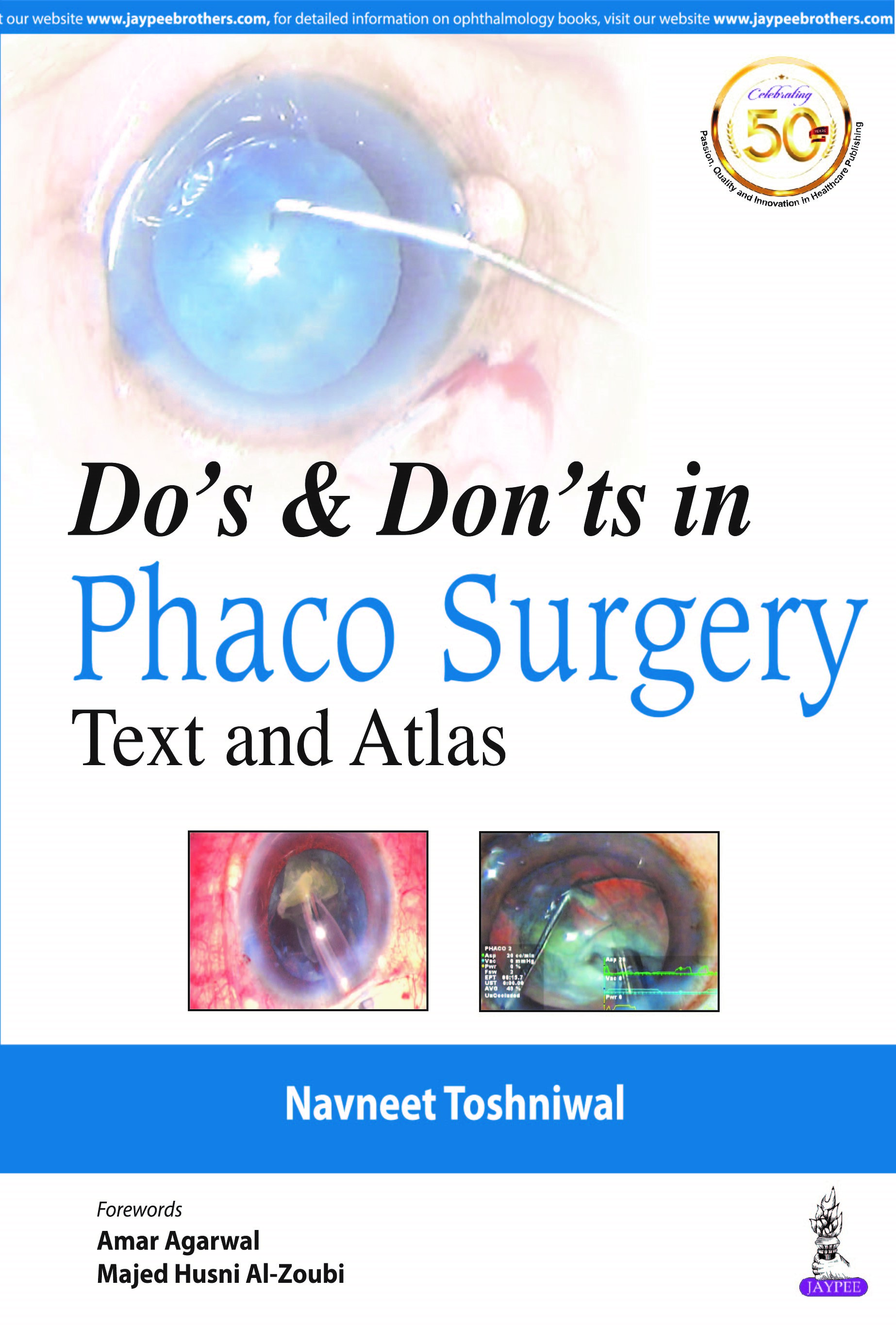 dos-donts-in-phaco-surgery-text-and-atlas