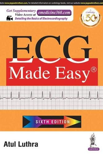 ecg-made-easy