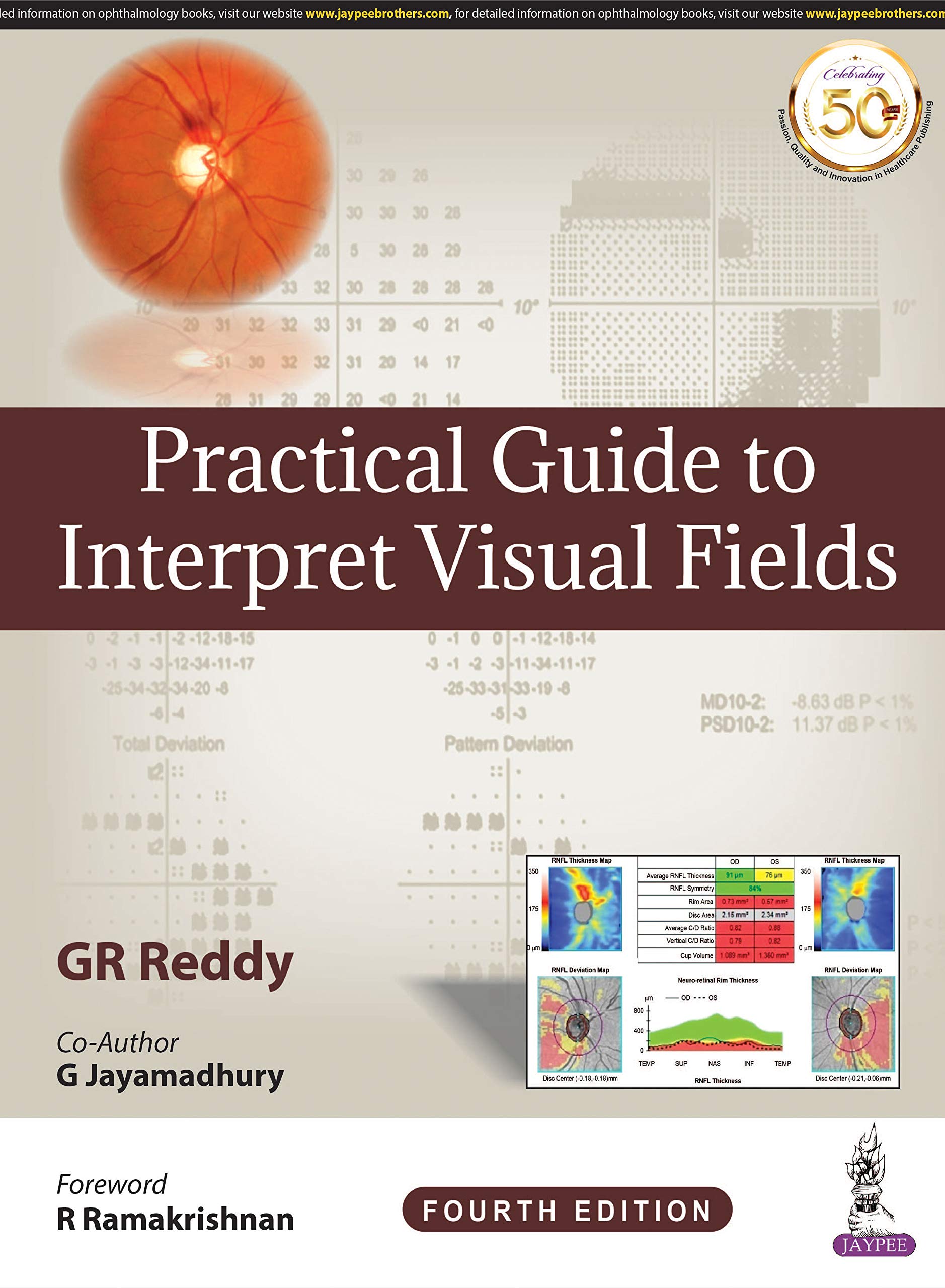 practical-guide-to-interpret-visual-fields