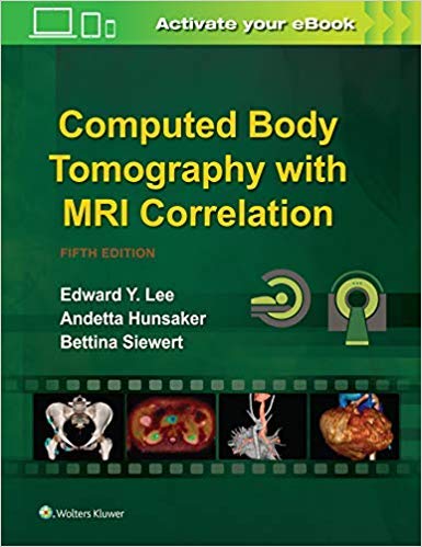 computed-body-tomography-with-mri-correlation