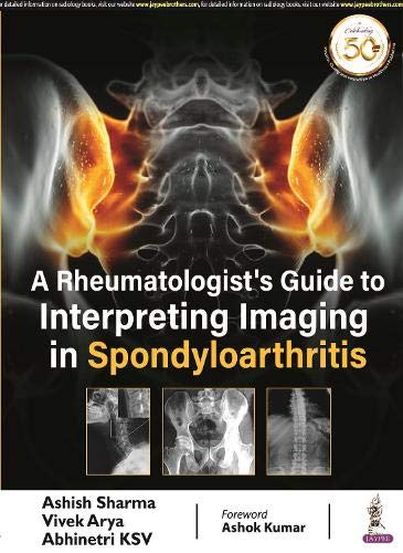 a-rheumatologists-guide-to-interpreting-imaging-in-spondyloarthritis