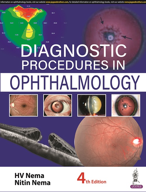 DIAGNOSTIC PROCEDURES IN OPHTHALMOLOGY