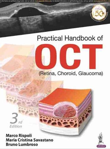 practical-handbook-of-oct-retina-choroid-glaucoma