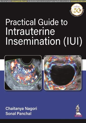 practical-guide-to-intrauterine-insemination-iui