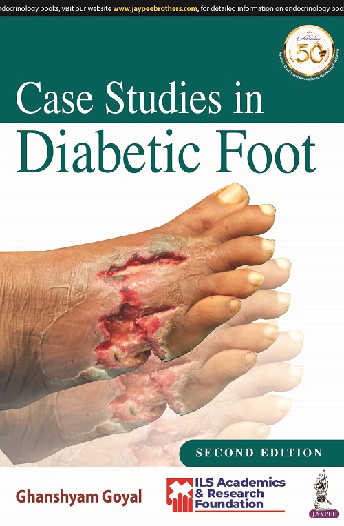 case-studies-in-diabetic-foot