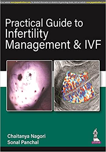 practical-guide-to-infertility-management-ivf
