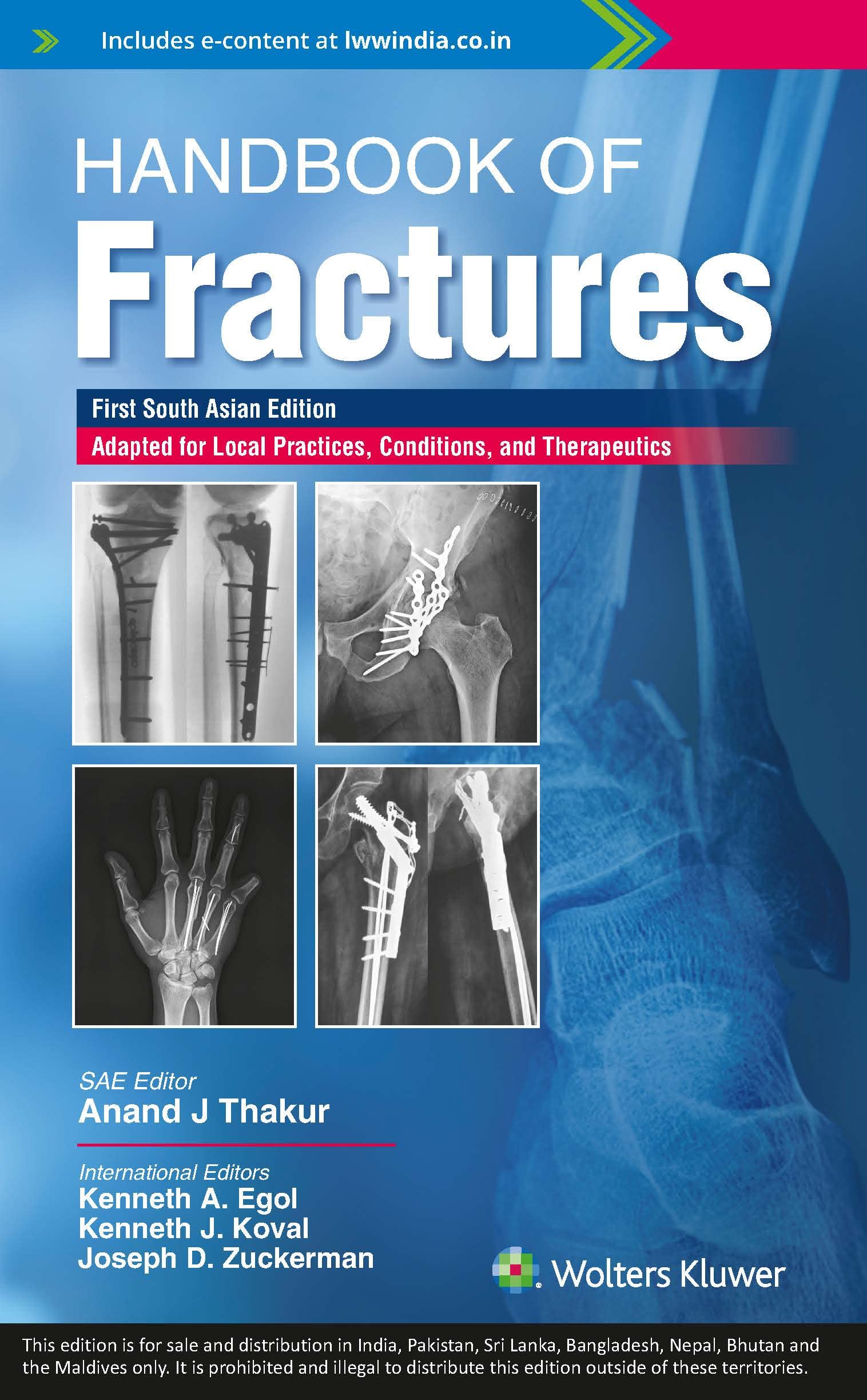 handbook-of-fractures-first-south-asia-edition