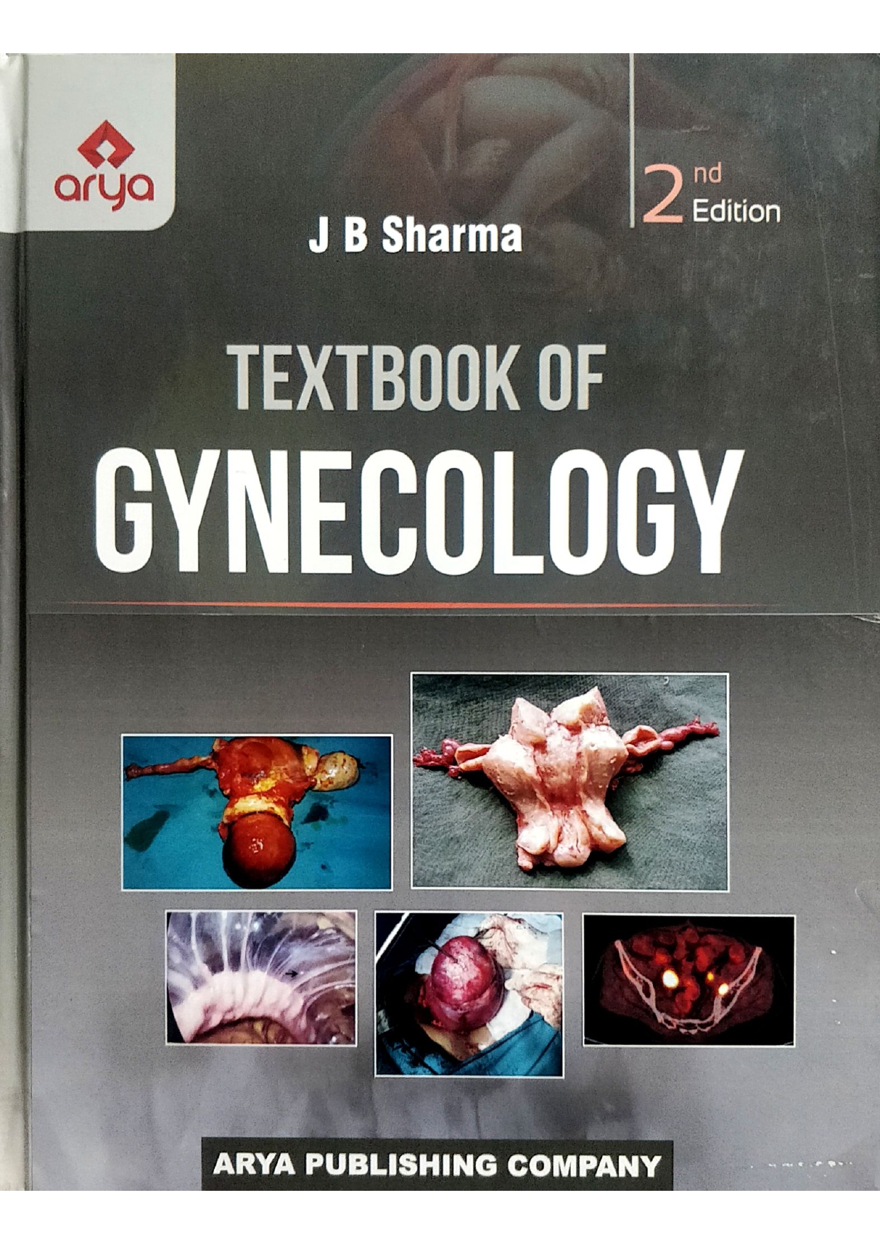 textbook-of-gynecology