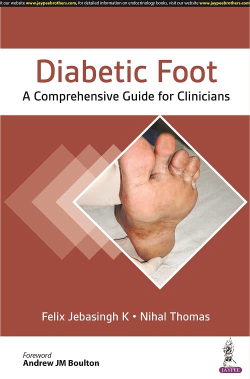 diabetic-foot-a-comprehensive-guide-for-clinicians