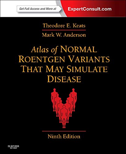 atlas-of-normal-roentgen-variants-that-may-simulate-disease-expert-consult-enhanced-online-features-and-print-9e